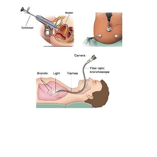 Laparoscopic Surgery for Children: Benefits and Recovery